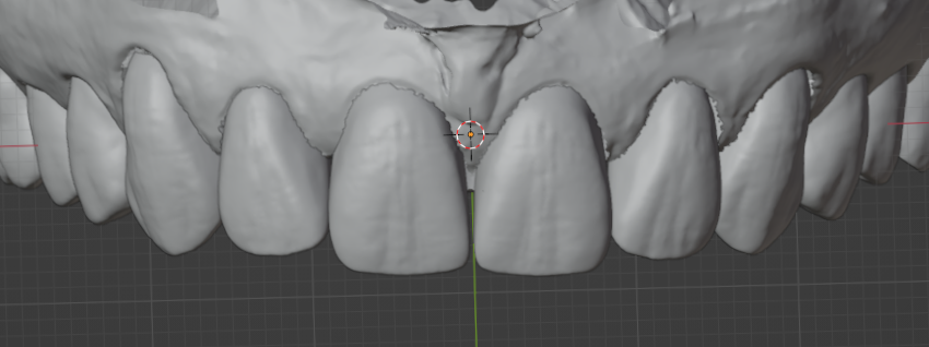 Smile example 2 - after