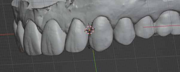 Smile example 3 - after