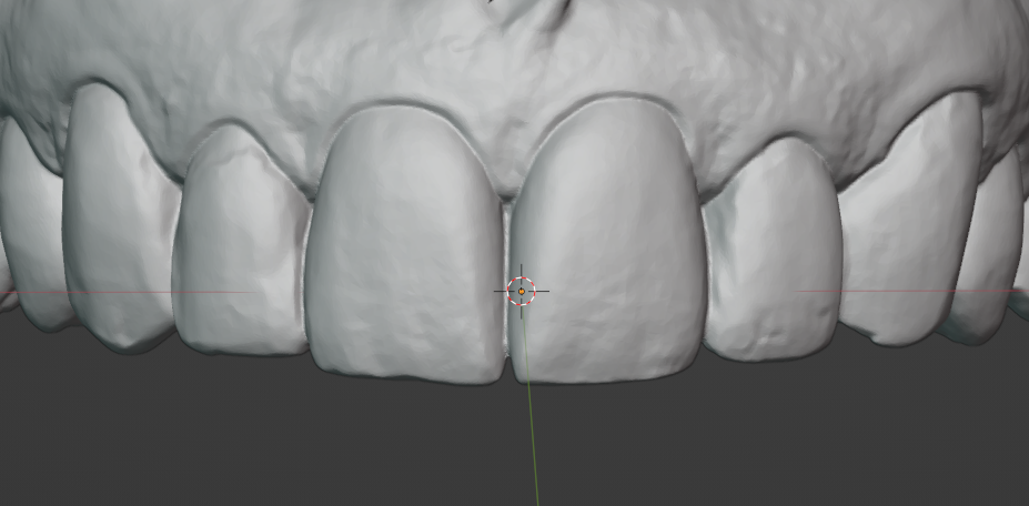 Smile example 1 - before