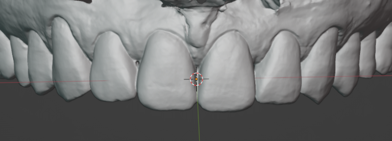 Smile example 2 - before