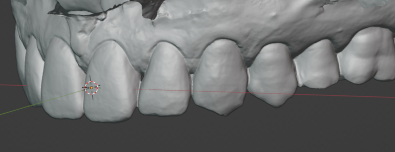Smile example 3 - before